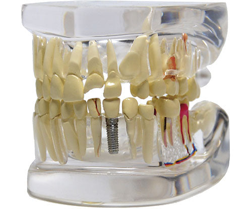 Clear Jaw with Pathologies