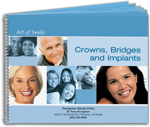 The Art of Smile Flip Guide: Crowns, Bridges and Implants