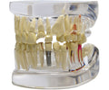 Clear Jaw with Pathologies