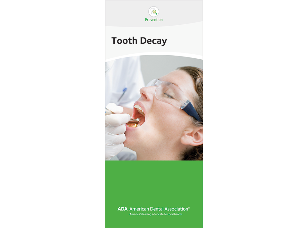 ADA Brochure: Tooth Decay