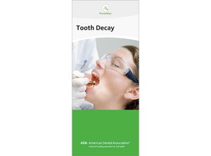 ADA Brochure: Tooth Decay