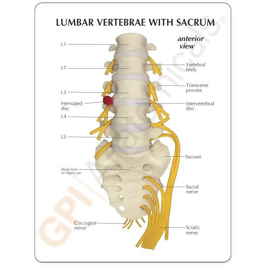 Anatomical Model- 5pc Vertebrae with sacrum