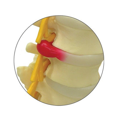 Anatomical Model- 5pc Vertebrae with sacrum