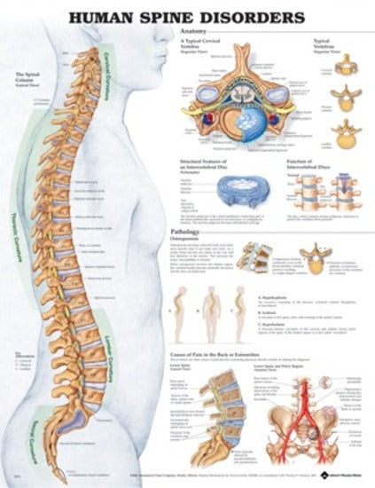 The Human Spine Disorders Anatomical Chart (50 x 61cm)