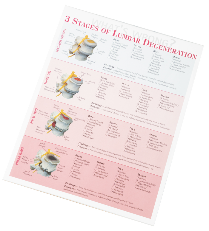 3 Stages of Lumbar Degeneration Handout