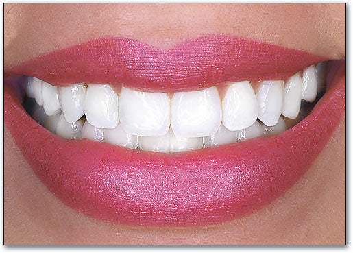 Perfect Teeth Postcard
