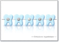 Silver Smile Postcard
