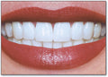 Close Up Smile Postcard