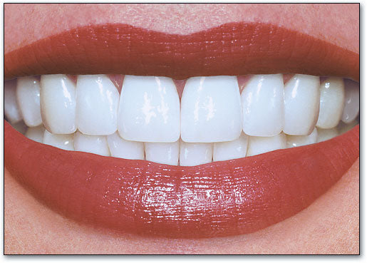 Close Up Smile Postcard