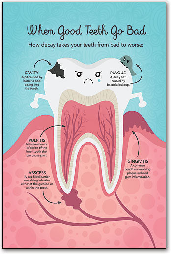 Molar Anatomy Poster