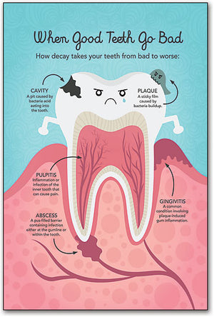 Molar Anatomy Poster
