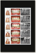 Stages of Perio Poster