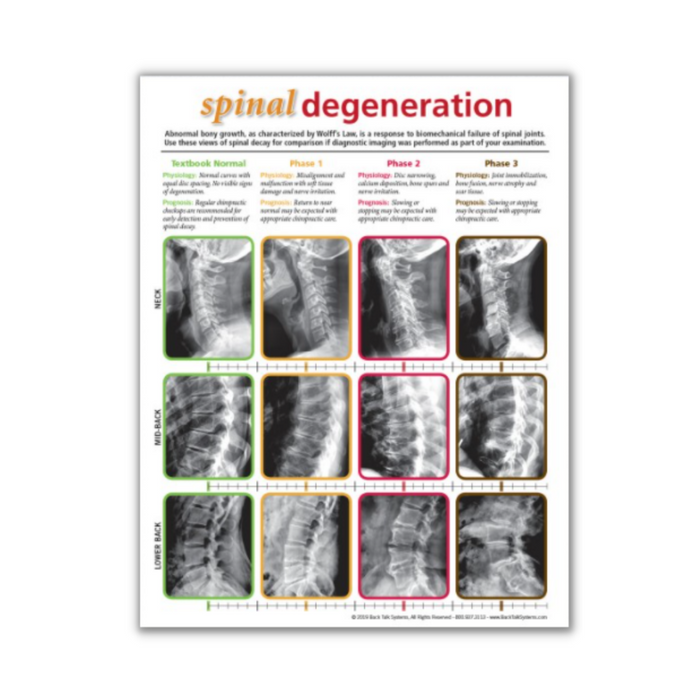 Spinal Degeneration Handout