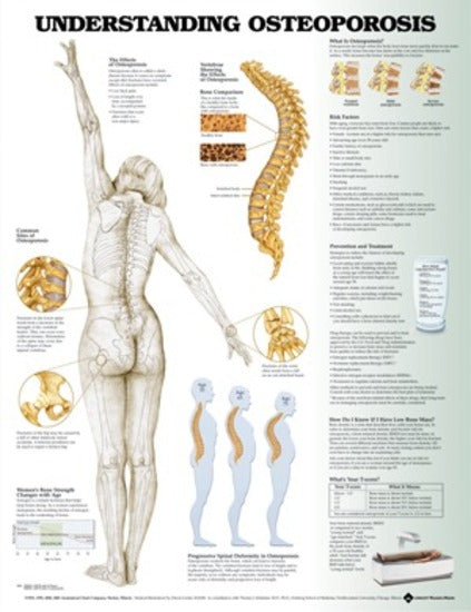 Understanding Osteoporosis Chart (50 x 61cm)